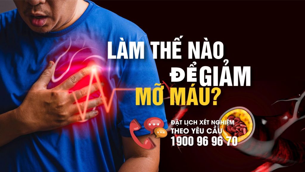 Giảm Mỡ Máu Bằng Cách Nào: Bí Quyết Hiệu Quả Và An Toàn