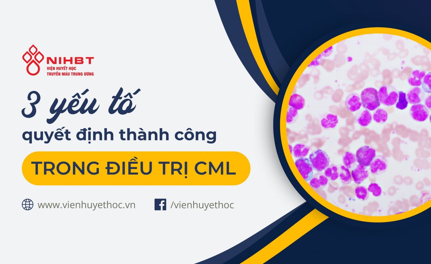 Yeu to quyet dinh thanh cong dieu tri CML (1)