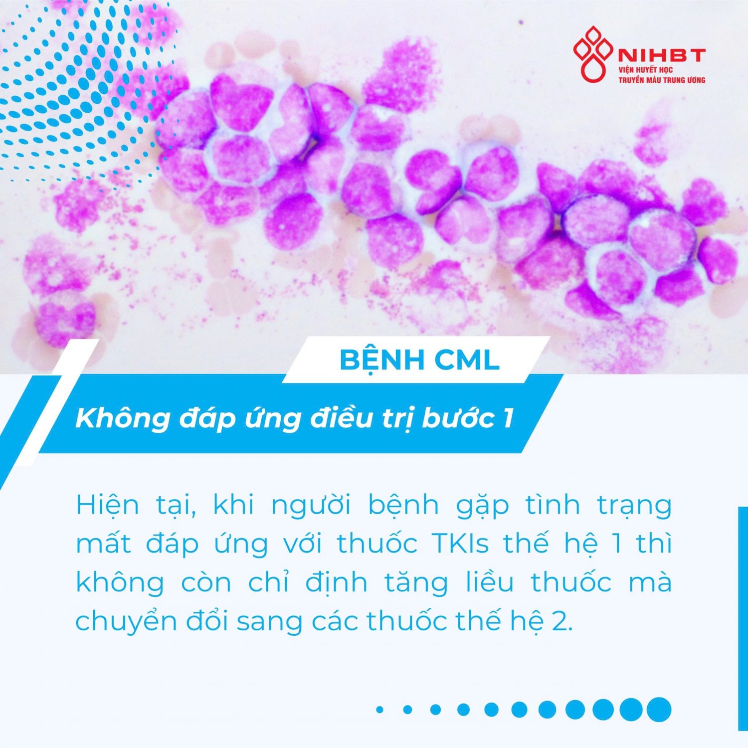 Benh CML khong dap ung dieu tri buoc 1 (2)